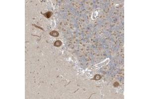 Immunohistochemical staining of human cerebellum with NPPC polyclonal antibody  shows moderate cytoplasmic positivity in purkinje cells. (NPPC anticorps)