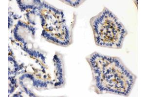 Caldesmon was detected in paraffin-embedded sections of mouse intestine tissues using rabbit anti- Caldesmon Antigen Affinity purified polyclonal antibody (Catalog # ) at 1 µg/mL.