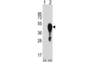 Western Blotting (WB) image for anti-Homeobox A1 (HOXA1) antibody (ABIN2998004) (HOXA1 anticorps)