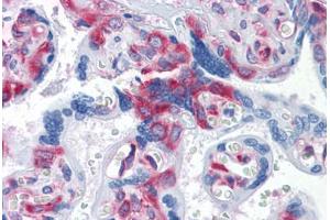 Human Placenta: Formalin-Fixed, Paraffin-Embedded (FFPE) (G3BP1 anticorps  (AA 214-303))