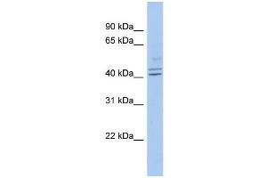 WB Suggested Anti-PROCA1 Antibody Titration: 0. (PROCA1 anticorps  (Middle Region))