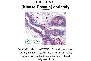 Image no. 1 for anti-PTK2 Protein tyrosine Kinase 2 (PTK2) antibody (ABIN1734244) (FAK anticorps)
