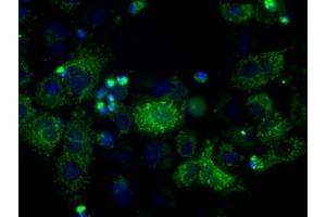 Image no. 10 for anti-ATP Synthase, H+ Transporting, Mitochondrial F1 Complex, beta Polypeptide (ATP5B) antibody (ABIN1496766)