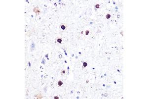 Immunohistochemistry of paraffin-embedded mouse spinal cord using  Rabbit pAb  at dilution of 1:100 (40x lens). (ATF2 anticorps)