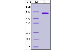 Human CD2, Fc Tag on  under reducing (R) condition.