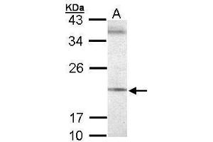 WB Image Sample (30 ug of whole cell lysate) A: 293T 12% SDS PAGE antibody diluted at 1:500 (SEC61G anticorps  (Center))