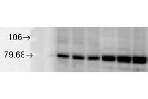 GRP78 Western Blot.