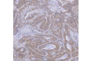 IHC analysis of WDR44 using anti-WDR44 antibody (ABIN7600394). (WDR44 anticorps  (AA 188-913))
