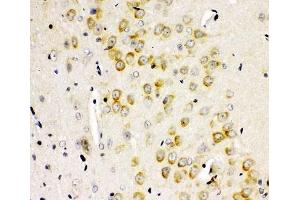 IHC-P: GLUR2 antibody testing of rat brain tissue (GRIA2 anticorps  (AA 25-360))