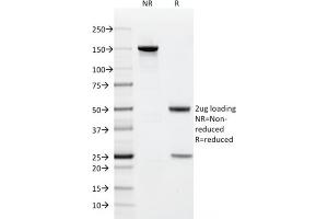 SDS-PAGE Analysis Purified CD9 Mouse Monoclonal Antibody (CD9/1619).