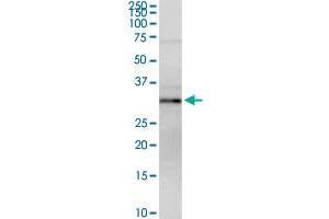 MPST MaxPab rabbit polyclonal antibody.