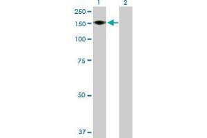 Western Blot analysis of ADAMTS18 expression in transfected 293T cell line by ADAMTS18 MaxPab polyclonal antibody. (ADAMTS18 anticorps  (AA 1-1221))