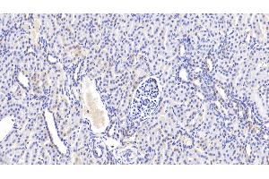Detection of ABCB10 in Human Kidney Tissue using Polyclonal Antibody to ATP Binding Cassette Transporter B10 (ABCB10)