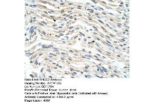 Rabbit Anti-THOC3 Antibody  Paraffin Embedded Tissue: Human Heart Cellular Data: Myocardial cells Antibody Concentration: 4. (THO Complex 3 anticorps  (Middle Region))