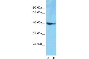 Host:  Rabbit  Target Name:  ACTB  Sample Type:  HepG2  Lane A:  Primary Antibody  Lane B:  Primary Antibody + Blocking Peptide  Primary Antibody Concentration:  1ug/ml  Peptide Concentration:  5.