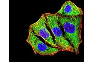 Immunocytochemistry (ICC) image for anti-Superoxide Dismutase 2, Mitochondrial (SOD2) (AA 1-222) antibody (ABIN5888812) (SOD2 anticorps  (AA 1-222))