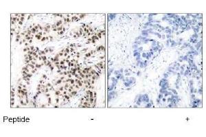 Image no. 2 for anti-Myc Proto-Oncogene protein (MYC) (Thr58) antibody (ABIN197154) (c-MYC anticorps  (Thr58))
