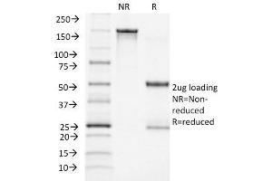 SDS-PAGE Analysis Purified ACTH Monoclonal Antibody (CLIP/1449). (POMC anticorps  (AA 25-39))