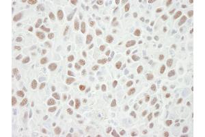Immunohistochemistry (IHC) image for anti-Minichromosome Maintenance Complex Component 6 (MCM6) (C-Term) antibody (ABIN7448656) (MCM6 anticorps  (C-Term))