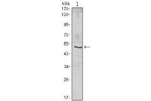 Western Blot showing NFKBIB antibody used against Jurkat (1) cell lysate. (NFKBIB anticorps)