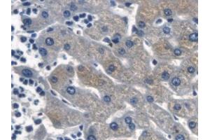 Detection of β-catenin in Human Liver Tissue using Polyclonal Antibody to Beta Catenin (β-catenin)