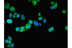 anti-Peroxiredoxin 5 (PRDX5) (AA 53-214) antibody