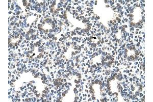 SLC43A3 antibody was used for immunohistochemistry at a concentration of 4-8 ug/ml to stain Alveolar cells (arrows) in Human Lung.