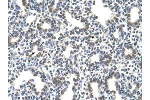 SLC43A3 antibody was used for immunohistochemistry at a concentration of 4-8 ug/ml to stain Alveolar cells (arrows) in Human Lung. (SLC43A3 anticorps  (N-Term))