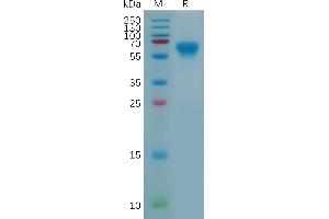 Mouse 4-1BB Protein, hFc Tag on SDS-PAGE under reducing condition.