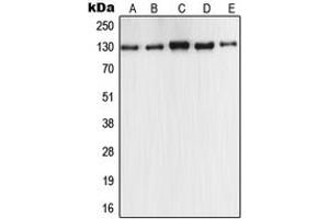 Western blot analysis of iNOS expression in MCF7 (A), A549 (B), Raw264. (NOS2 anticorps  (C-Term))