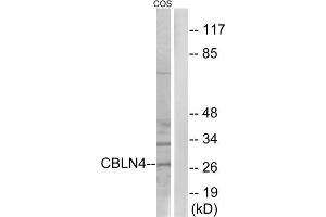 Western blot analysis of extracts from COS cells, using CBLN4 antibody. (CBLN4 anticorps  (C-Term))