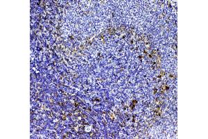 IHC analysis of CD8 alpha using anti-CD8 alpha antibody .