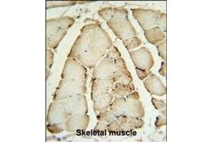 CRAT Antibody (N-term) (ABIN390481 and ABIN2840845) IHC analysis in formalin fixed and paraffin embedded human Skeletal muscle followed by peroxidase conjugation of the secondary antibody and DAB staining.