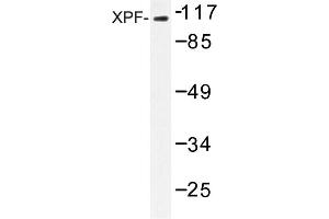 Image no. 1 for anti-Excision Repair Cross-Complementing Rodent Repair Deficiency, Complementation Group 4 (ERCC4) antibody (ABIN272306) (ERCC4 anticorps)