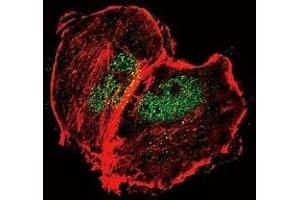 Confocal immunofluorescent analysis of phospho-Tuberin antibody with MCF-7 cells followed by Alexa Fluor 488-conjugated goat anti-rabbit lgG (green).