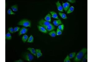 Immunofluorescence staining of Hela cells with ABIN7169831 at 1:166, counter-stained with DAPI. (SCIMP anticorps  (AA 59-145))