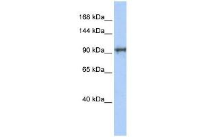 CCDC52 antibody used at 1 ug/ml to detect target protein. (SPICE1 anticorps  (N-Term))