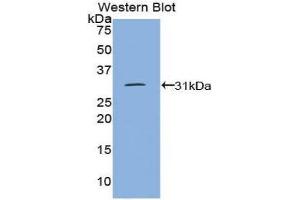 Western Blotting (WB) image for anti-Protein tyrosine Phosphatase, Receptor Type, J (PTPRJ) (AA 1061-1293) antibody (ABIN3206459) (PTPRJ anticorps  (AA 1061-1293))