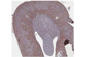 anti-Cystathionine-beta-Synthase (CBS) (N-Term) antibody