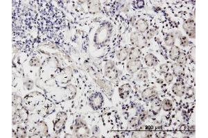 Immunoperoxidase of monoclonal antibody to CALML3 on formalin-fixed paraffin-embedded human salivary gland. (CALML3 anticorps  (AA 1-149))