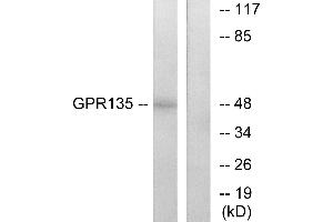 Western blot analysis of extracts from NIH-3T3 cells, using GPR135 antibody. (GPR135 anticorps  (Internal Region))
