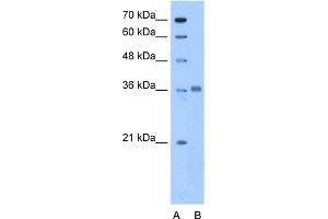 WB Suggested Anti-ALDOC Antibody Titration:  0. (ALDOC anticorps  (N-Term))