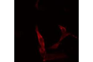 ABIN6266515 staining COLO205 cells by IF/ICC.