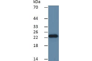 WB of Protein Standard: different control antibodies against Highly purified E.