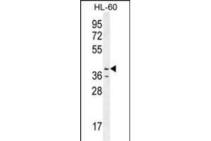 CASP12 Antibody (Center) (ABIN655966 and ABIN2845350) western blot analysis in HL-60 cell line lysates (35 μg/lane). (Caspase 12 anticorps  (AA 165-193))