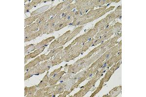 Immunohistochemistry of paraffin-embedded rat heart using SMN2 antibody. (SMN1 anticorps)