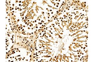 anti-NADPH Dependent Diflavin Oxidoreductase 1 (NDOR1) (N-Term) antibody