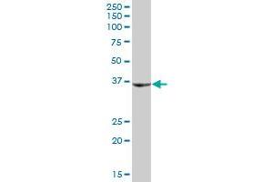 SHOX MaxPab polyclonal antibody.