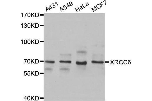 XRCC6 anticorps  (AA 500-600)