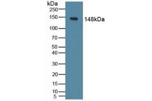 Detection of PIK3Cd in Mouse Liver Tissue using Polyclonal Antibody to Phosphoinositide-3-Kinase Catalytic Delta Polypeptide (PIK3Cd) (PIK3CD anticorps  (AA 774-1044))